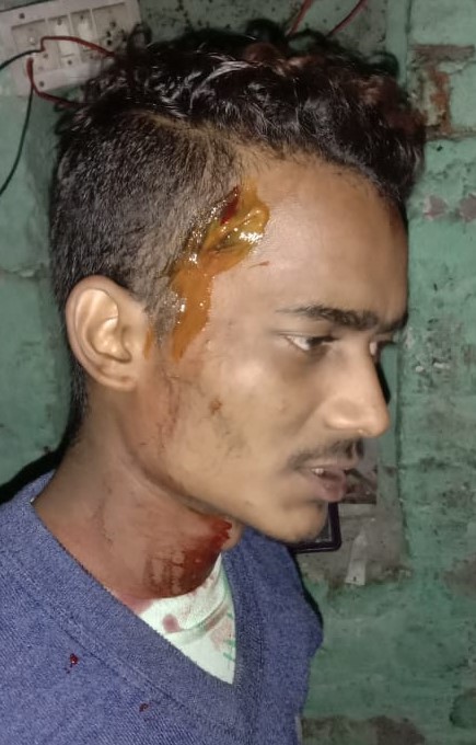 स्कूटी धीरे चलाने को कहा तो जमकर पीटा युवा उद्यमी व कर्मचारी
